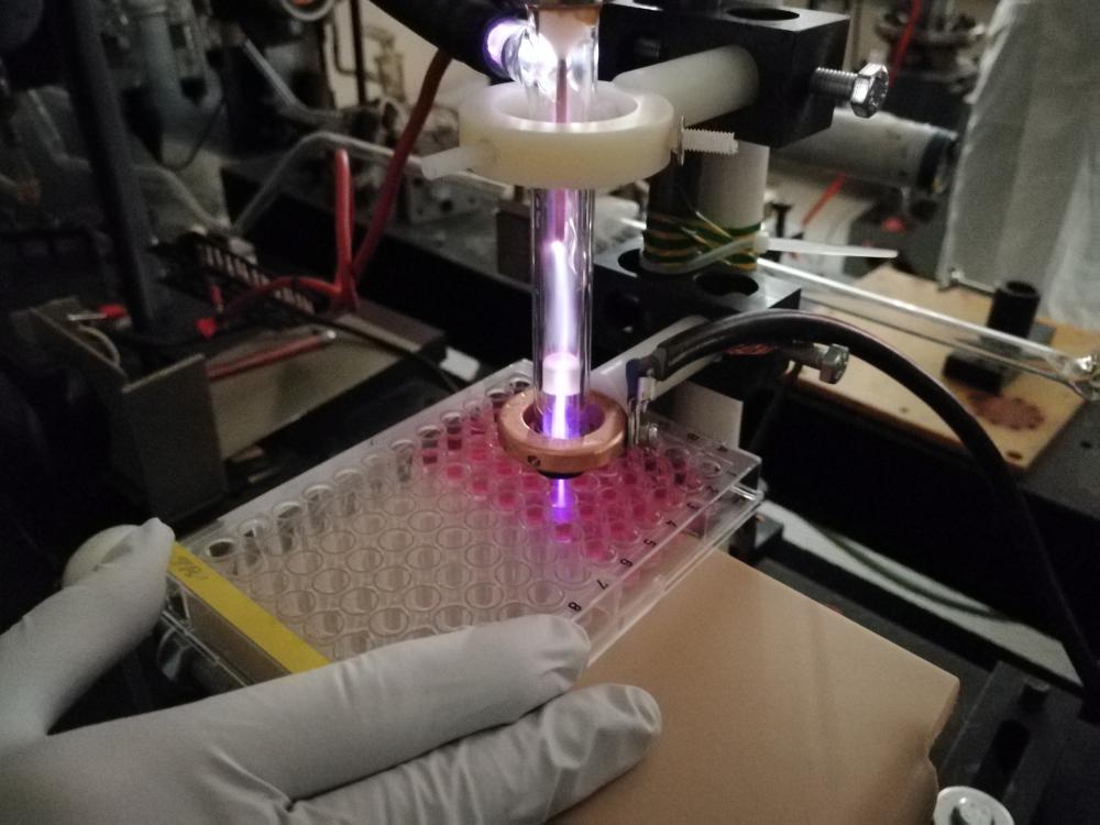 "Plasma ray in the realm of cancer": NSTU NETI scientists have created a plasma gun to fight cancer cells (video)